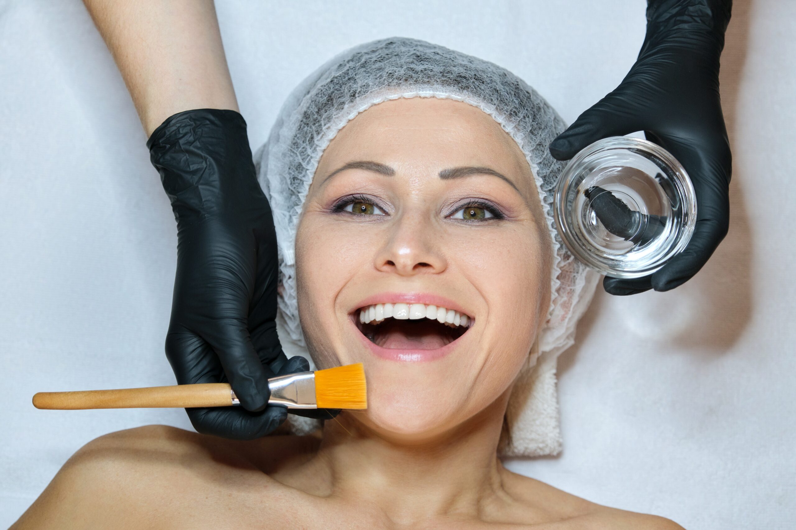 cosmetic-smile-makeover