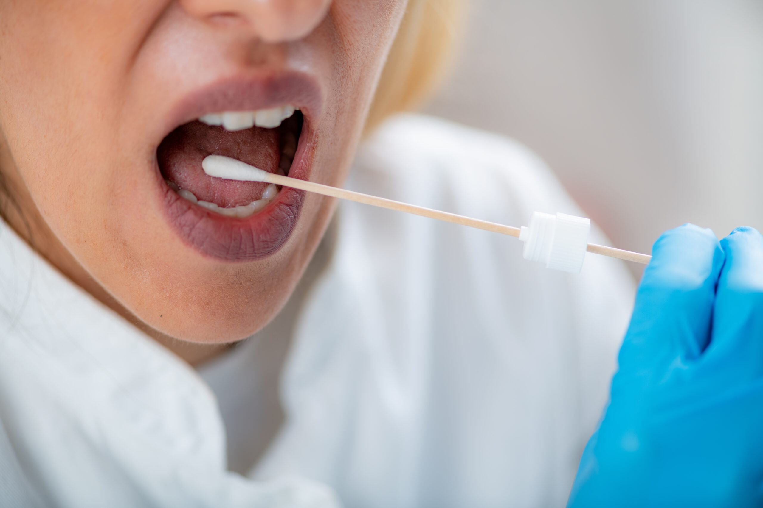 bleeding-gum-emergency-care