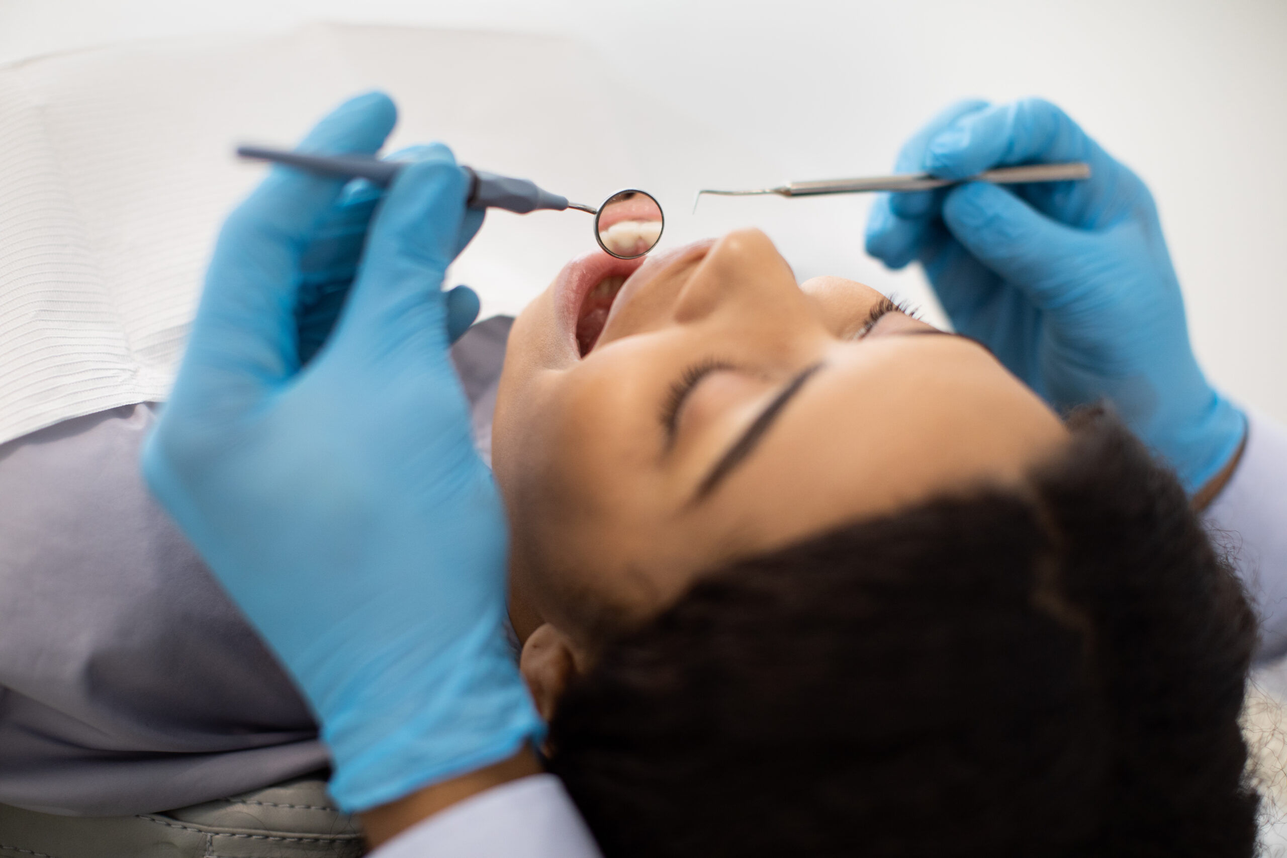 professional-teeth-cleaning
